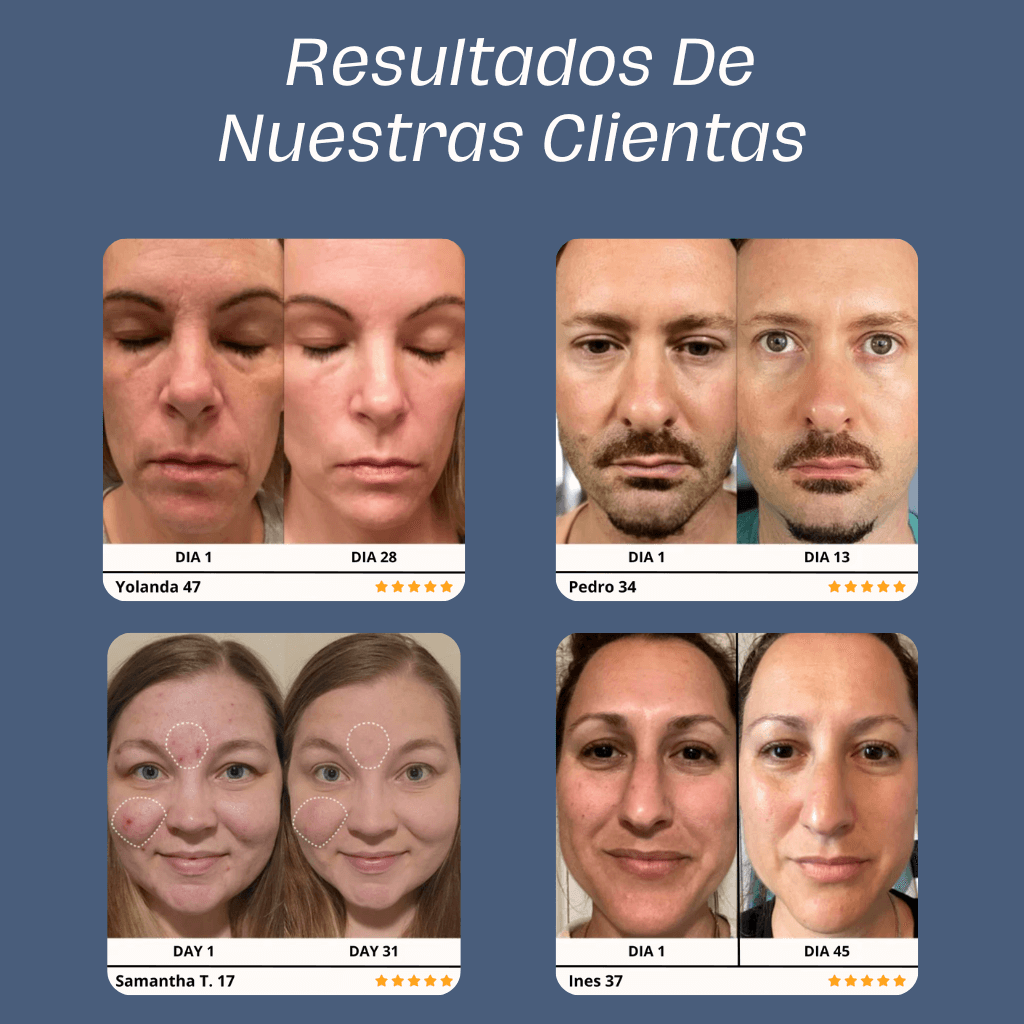 Skin Glow 2.0™ | El Mejor Aliado Para Tu Piel