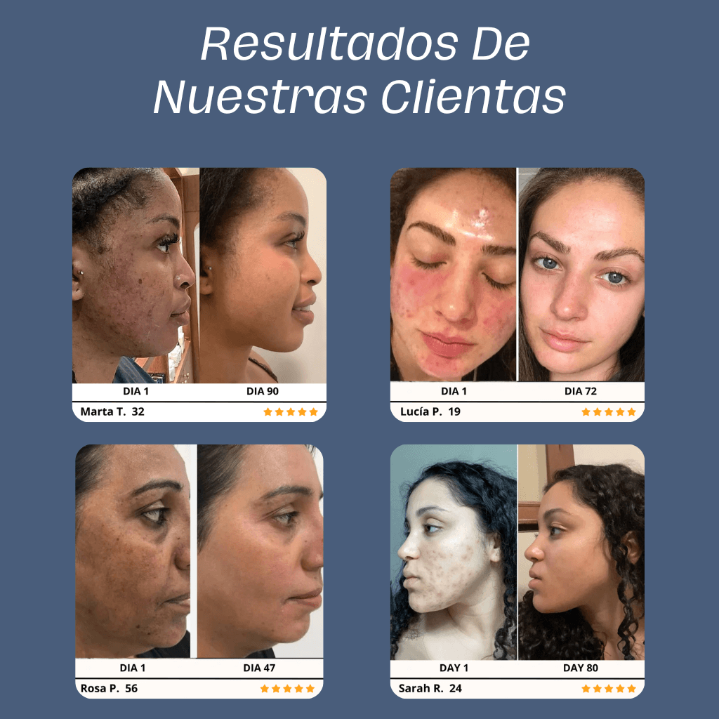 Skin Glow 2.0™ | El Mejor Aliado Para Tu Piel